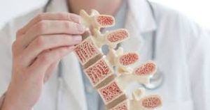 Read more about the article Kako ohranimo močne kosti